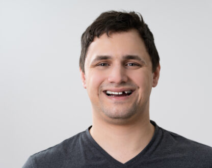 The Benefits of Dental Implants: Why are they the Best Solution for Missing Teeth?