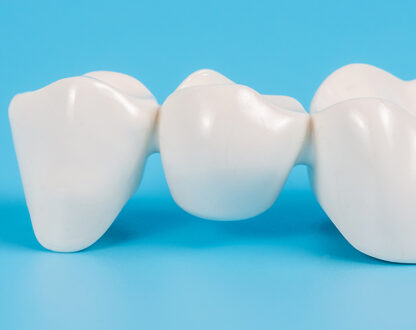 Why Should You Invest in Dental Crowns?