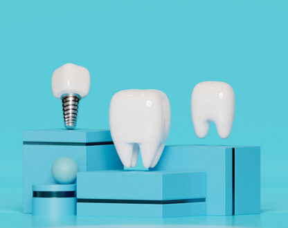 How Do Dental Implants Work to Restore Your Smile?