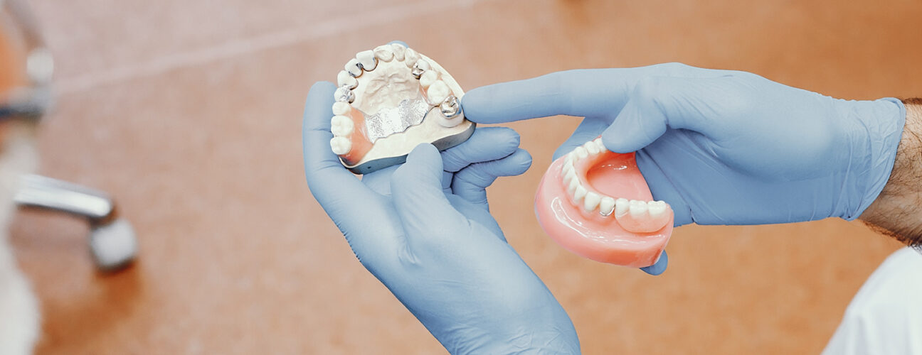 How Long Does It Take to Remove a Dental Bridge? What to Expect