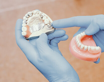 How Long Does It Take to Remove a Dental Bridge? What to Expect