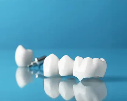 Symptoms of a Loose Crown: How Can You Prevent Further Damage?